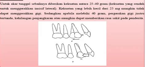 Pergerakan Gigi (Tooth Movement) .